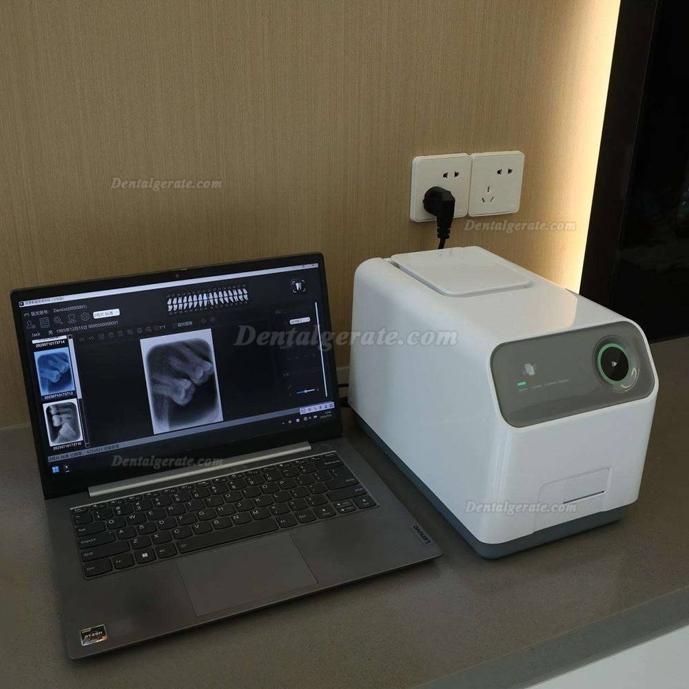 Handy VS-IPS3 Dental Speicherfolienscanner / Digitales Bildgebungssystem f&uuml;r Phosphorplatten
